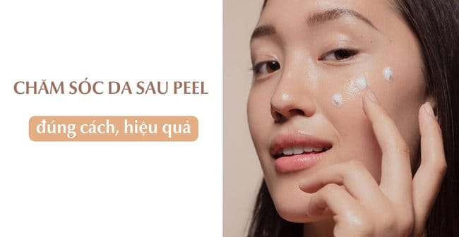 Cách chăm sóc da sau peel an toàn, hiệu quả