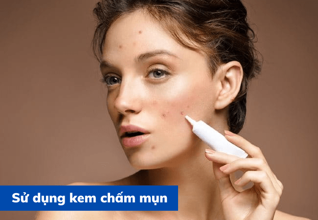 Sử dụng kem chấm mụn