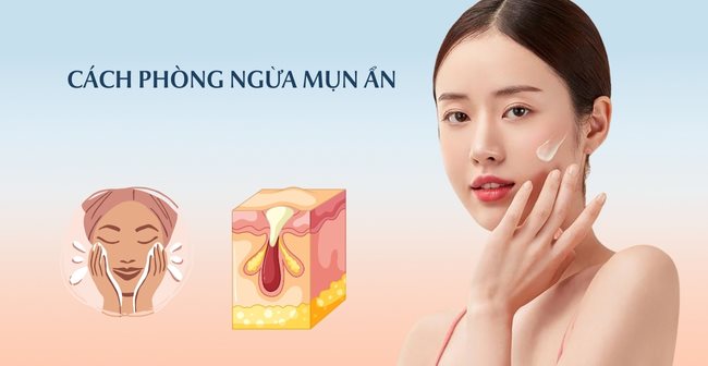 Cách phòng ngừa mụn ẩn dưới da hiệu quả