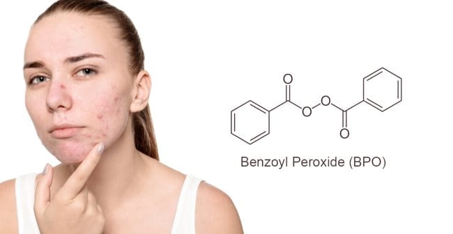 Cách trị mụn tuổi dậy thì bằng Benzoyl Peroxide