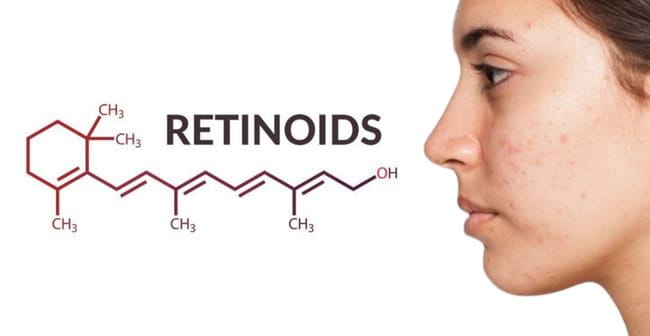 Cách trị mụn tuổi dậy thì với Retinol