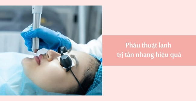 Phẫu thuật lạnh trị tàn nhang hiệu quả