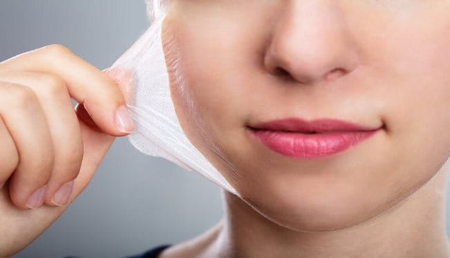  Peel da là gì? Peel da có tốt không?