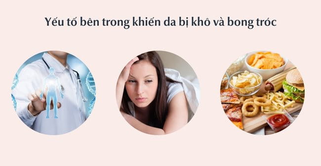 Yếu tố bên trong khiến da bị khô và bong tróc