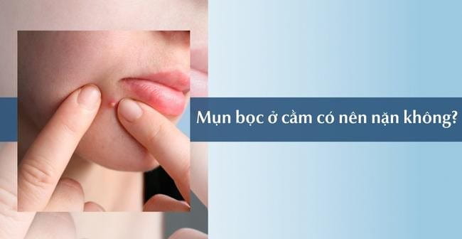 Không tự ý nặn mụn bọc ở cằm hoặc làm vỡ nhân mụn