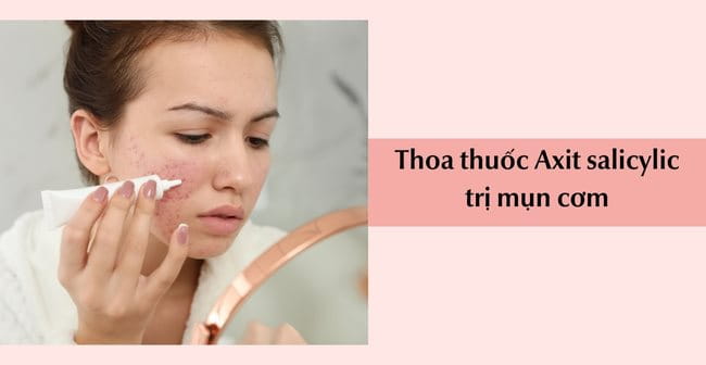 Thoa thuốc Axit salicylic trị mụn cơm