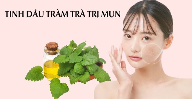 Phương pháp trị mụn nội tiết bằng tinh dầu tràm trà