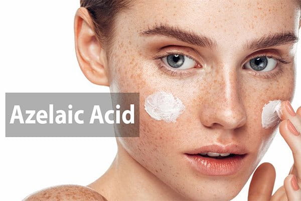 Điều trị nám mảng bằng Acid Azelaic