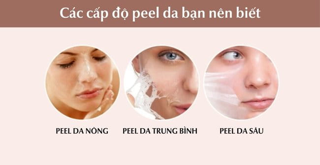 Các cấp độ Chemical peels da