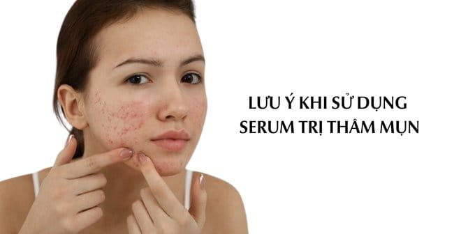 Một số lưu ý khi sử dụng serum trị thâm mụn