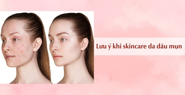 Những nguyên tắc cần lưu ý khi skincare cho da dầu mụn