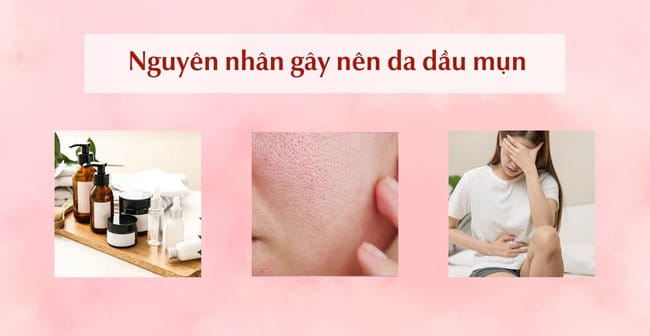 Nguyên nhân gây nên tình trạng da dầu mụn