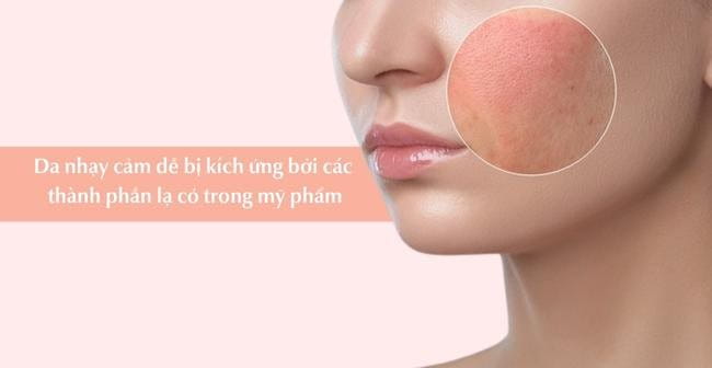 Da nhạy cảm dễ bị kích ứng bởi các thành phần lạ có trong mỹ phẩm