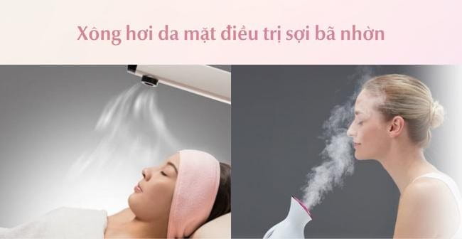 Trị sợi bã nhờn bằng biện pháp xông mặt